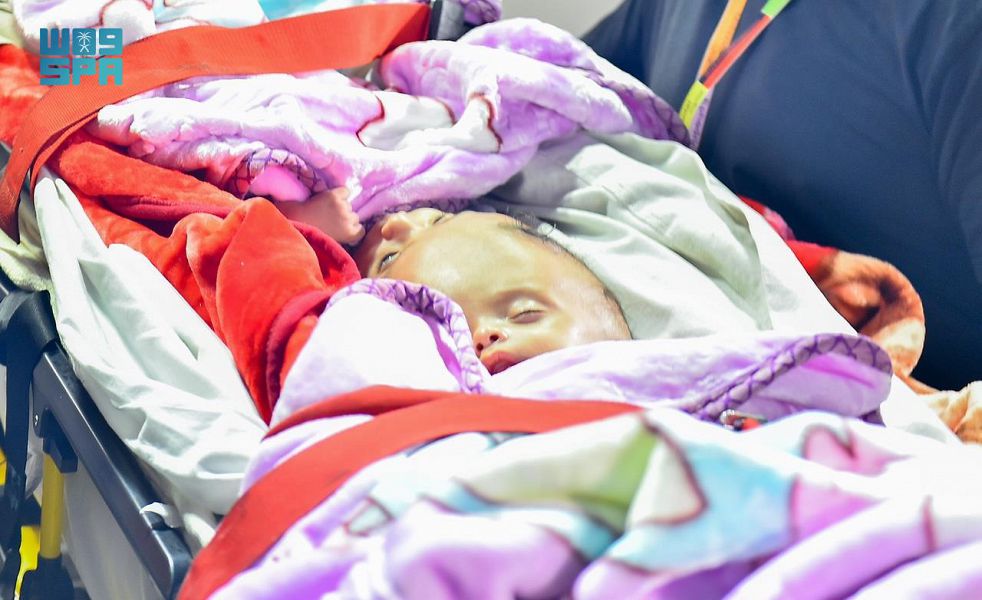 Yemeni conjoined twins “Yousuf and Yassin” arrived in Riyadh via an air medical evacuation plane from Al-Mukalla. (SPA)