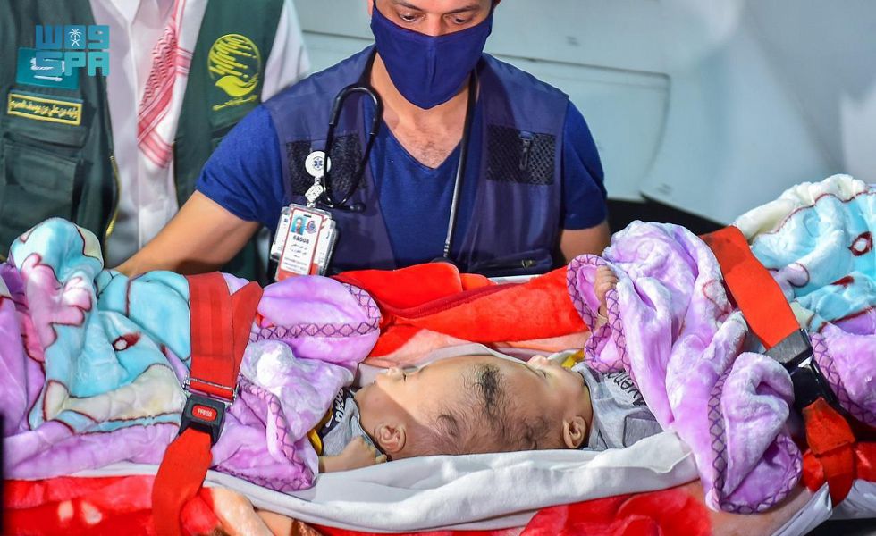 Yemeni conjoined twins “Yousuf and Yassin” arrived in Riyadh via an air medical evacuation plane from Al-Mukalla. (SPA)