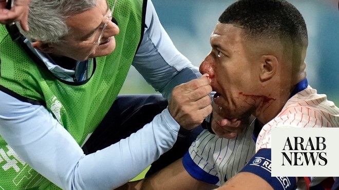 Mbappé’s facial injury places doubt on his continued involvement in Euro 2024