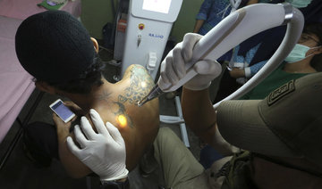 Indonesia clinic gives relief to Muslims with tattoo regrets