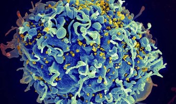 Nearly four in 10 US HIV infections from people unaware of infection