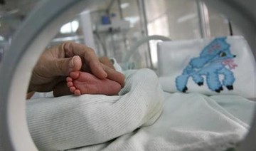 11 more cases of babies born with deformed arms in France