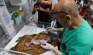 Gazans mourn baby who dies after rescue from dead mother’s womb
