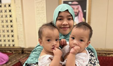 Saudi team in Manila to transport Filipino conjoined twins for surgery in Riyadh