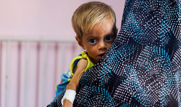A child looks on at Nasser hospital in Khan Younis, in the southern Gaza Strip, July 8, 2024. (REUTERS)