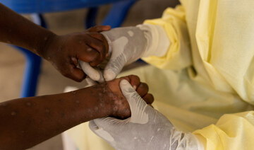 Africa’s CDC declares mpox a public health emergency