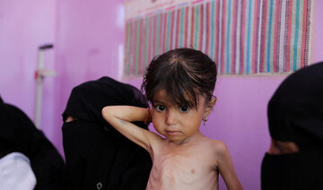 Famine looms in 4 Yemeni districts as hunger surges among children