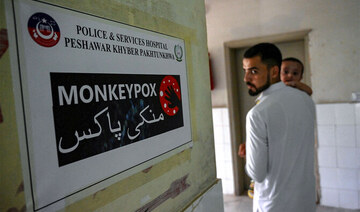 Pakistan confirms second mpox case in country’s northwest 