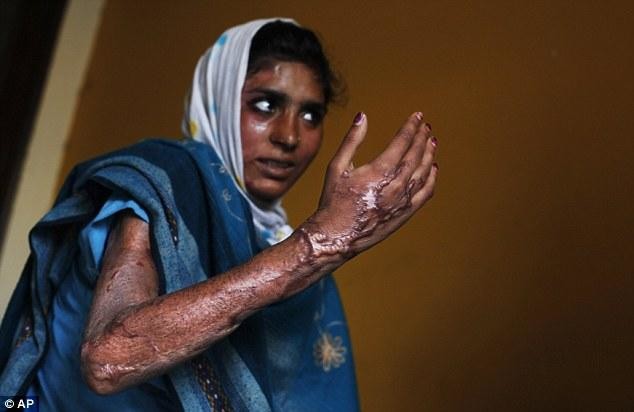 Indian woman attacked with acid for fifth time: police