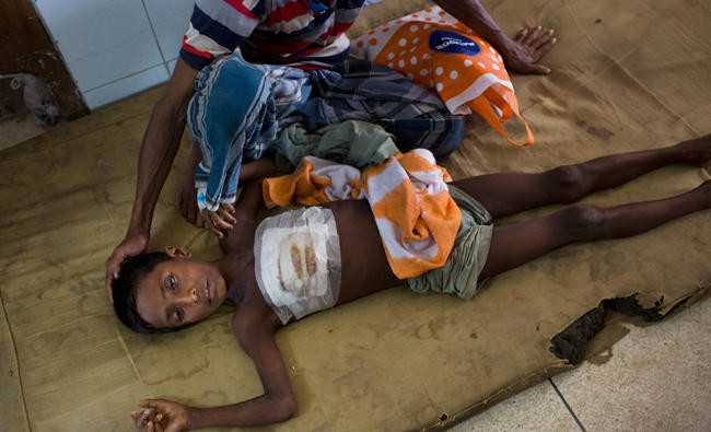 Bangladesh hospital struggles to cope with Rohingya wounds