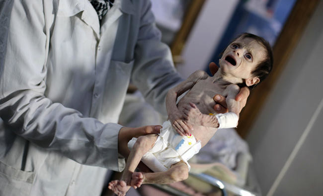 Syrian children die of hunger under regime siege