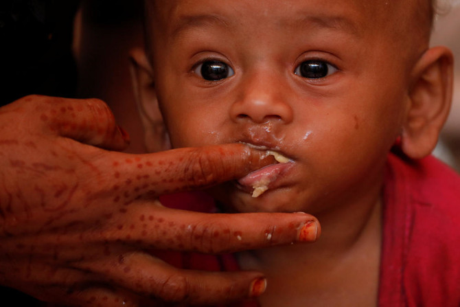 Hunger gnaws at Rohingya children in Bangladesh’s refugee camps