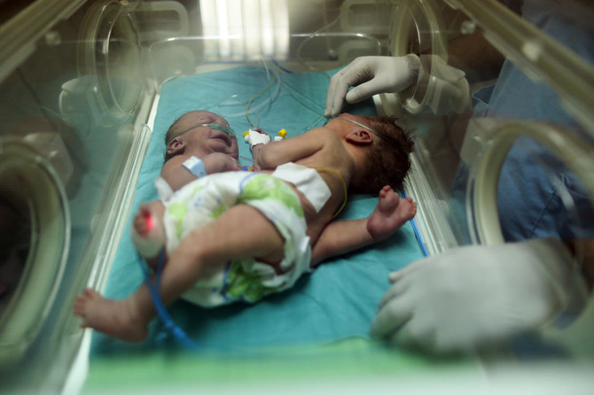 Palestinian conjoined twins arrive in Riyadh