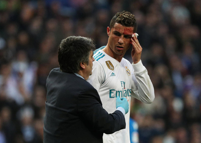 Cristiano Ronaldo requires stitches after nasty head injury