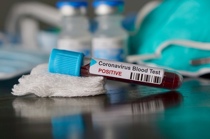 UAE confirms 2 new coronavirus cases