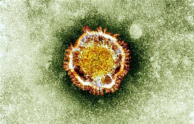 Saudi Arabia detects second coronavirus case