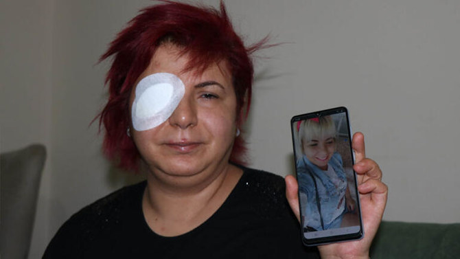 Woman close to being blind after botched Turkey treatment