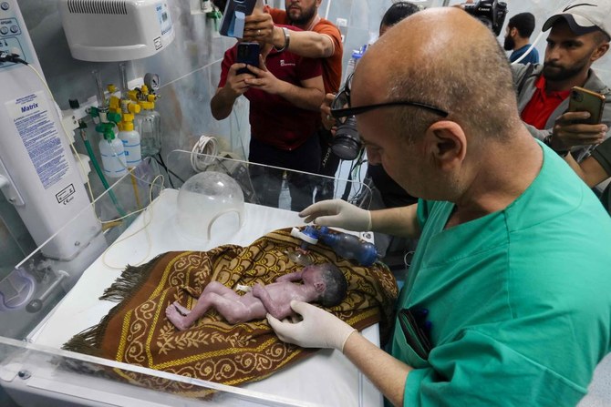 Gazans mourn baby who dies after rescue from dead mother’s womb