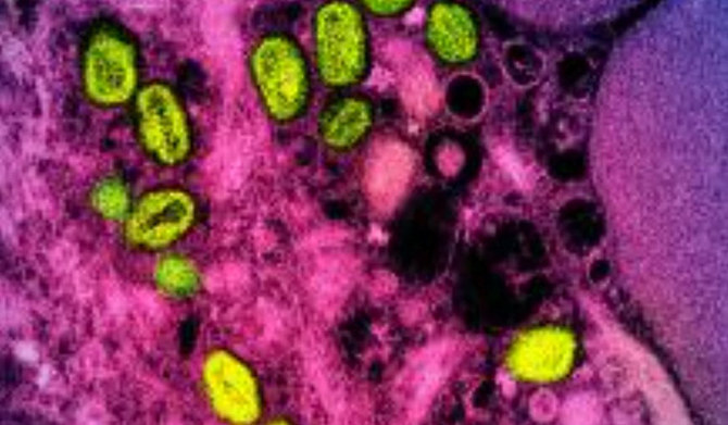 Kenya reports first mpox case