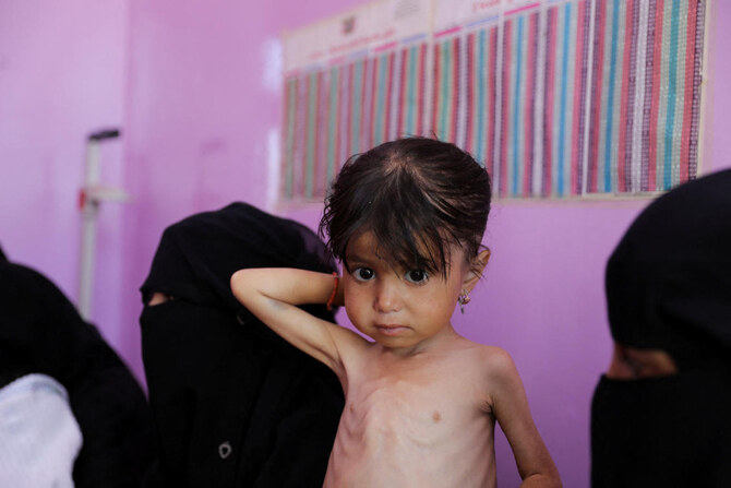 Famine looms in 4 Yemeni districts as hunger surges among children