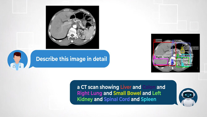 How a cutting-edge AI model developed in Saudi Arabia is reshaping medical diagnostics