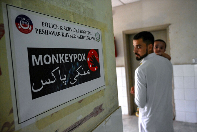 Pakistan confirms second mpox case in country’s northwest 