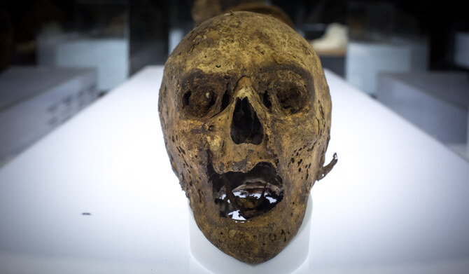 An Andean mummified head belonging to the Coolen collection is prepared to be displayed at the "Athanatos. (AFP file photo)